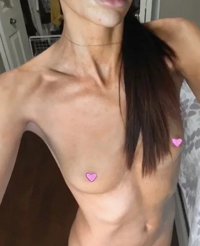 Candace