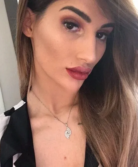 ROSA_ANAL
